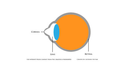 Keratoconus Eye model