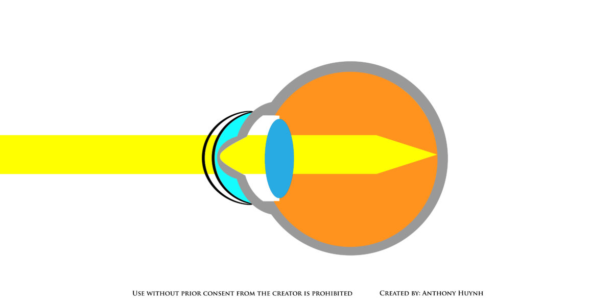 Scleral Light Diagram